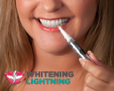 Whitening Lightning